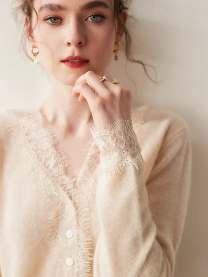 Rosie Fitted Cardigan | Lace Trim Button Front Cardigan