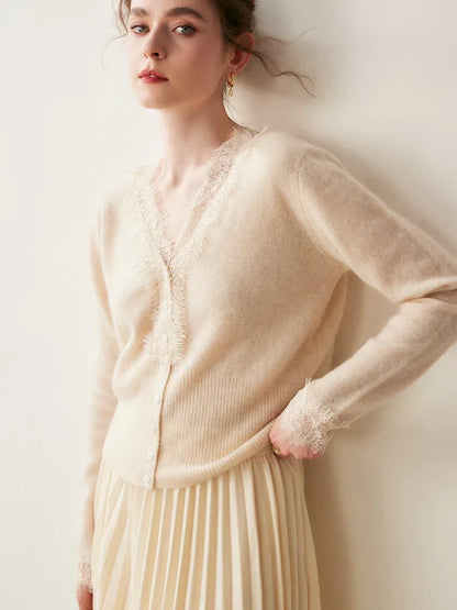 Rosie Fitted Cardigan | Lace Trim Button Front Cardigan